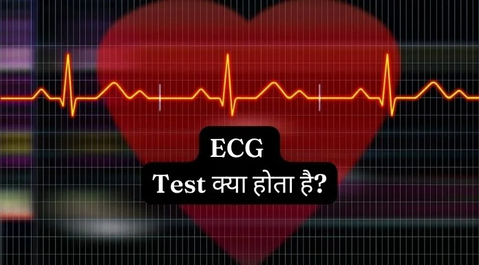 ecg-test